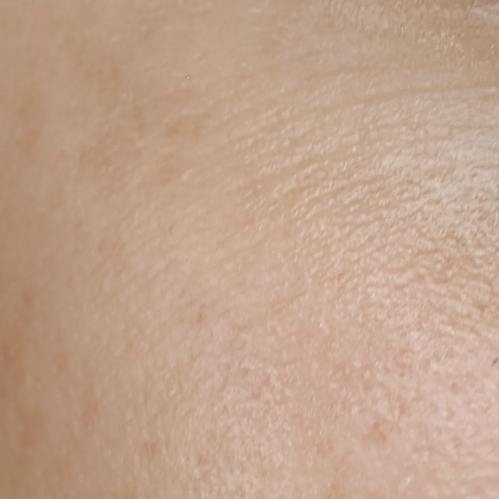 Mature Skin
