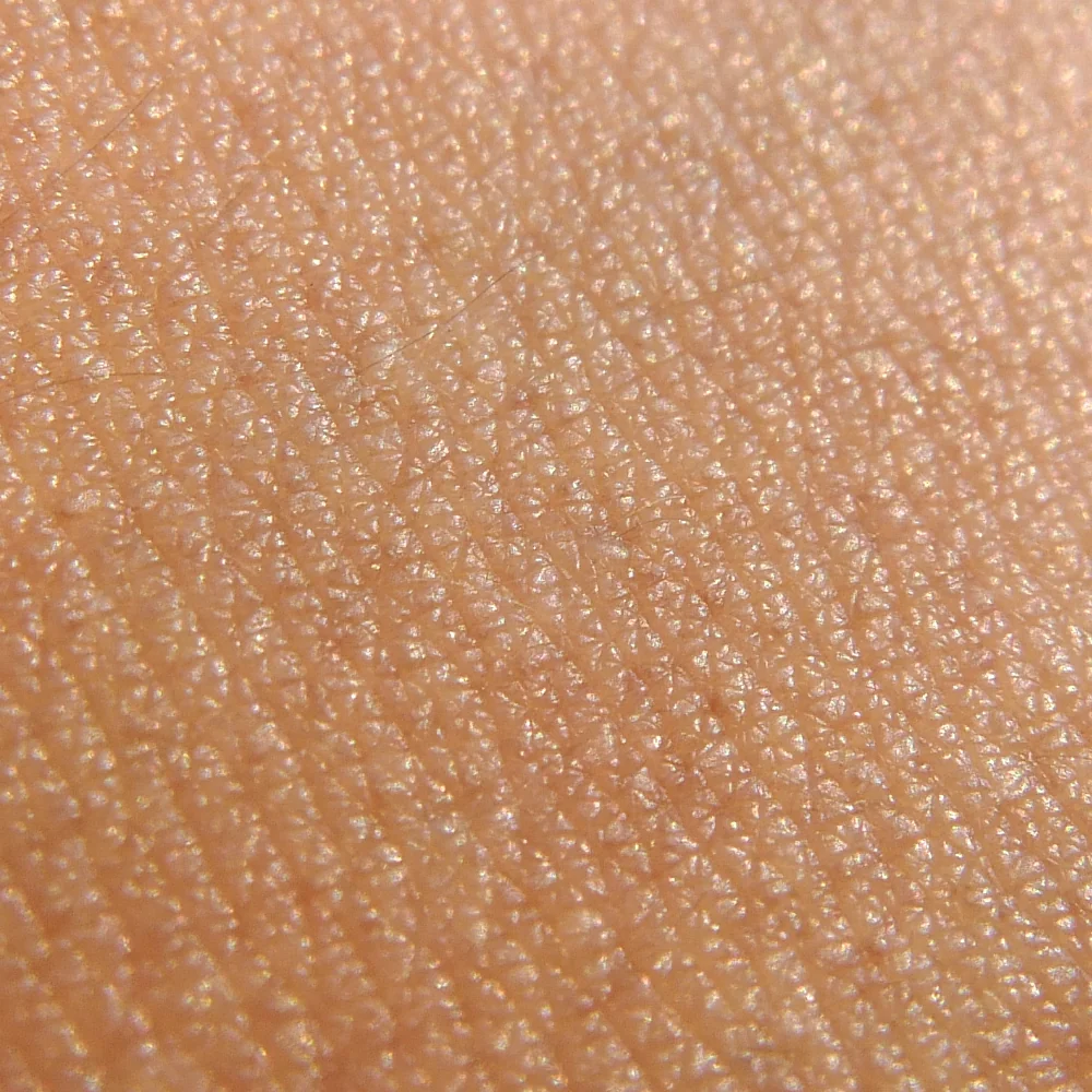 Normal Skin